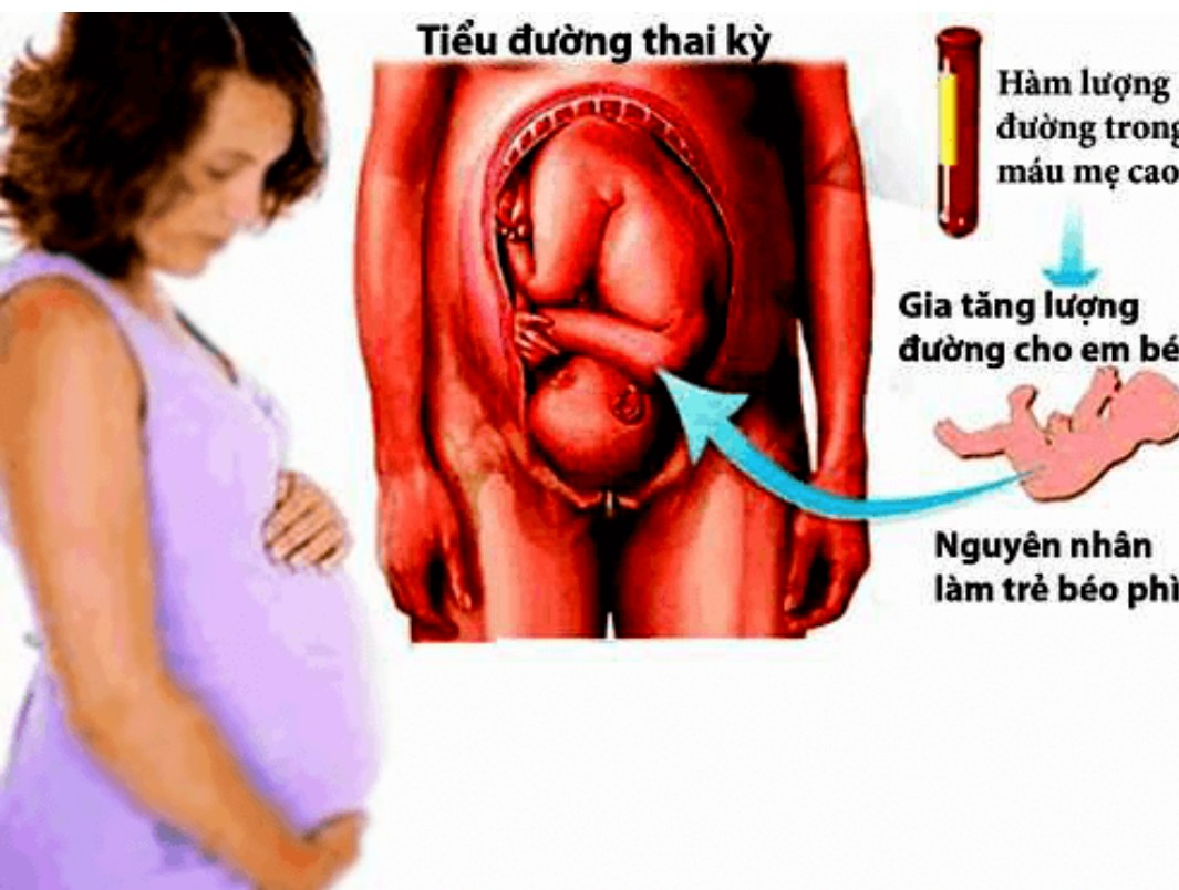 Tiếp nhận, xử lý sản phụ có tiền sử tiểu đường thai kỳ và những ...