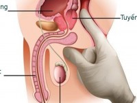 Cảnh báo những dấu hiệu vỡ hang vật ở nam giới.