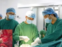 Sau nuốt hạt nhót, cụ bà cao tuổi phải phẫu thuật cấp cứu vì thủng trực tràng